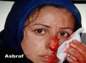 حمله شش و هفت مرداد به کمپ اشرف- یک زن مجاهد زخمی